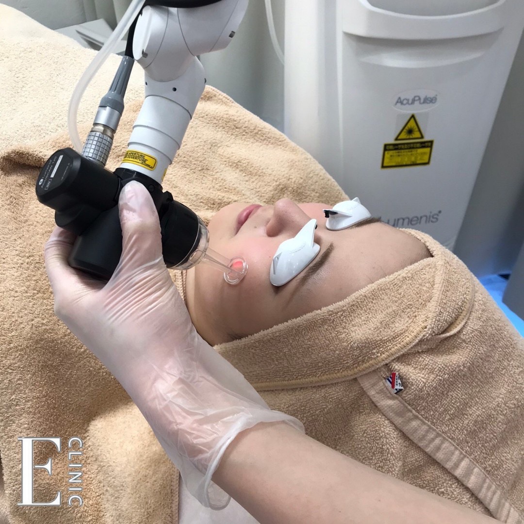 Acu Pulse(アキュパルス)を 導入いたしました！ - イーメディカルクリニック麻布