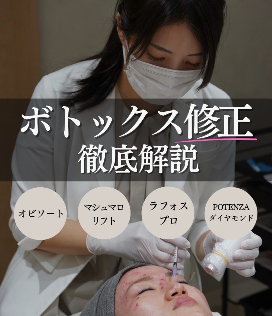 【効きすぎたボトックスにお悩みの方へ】