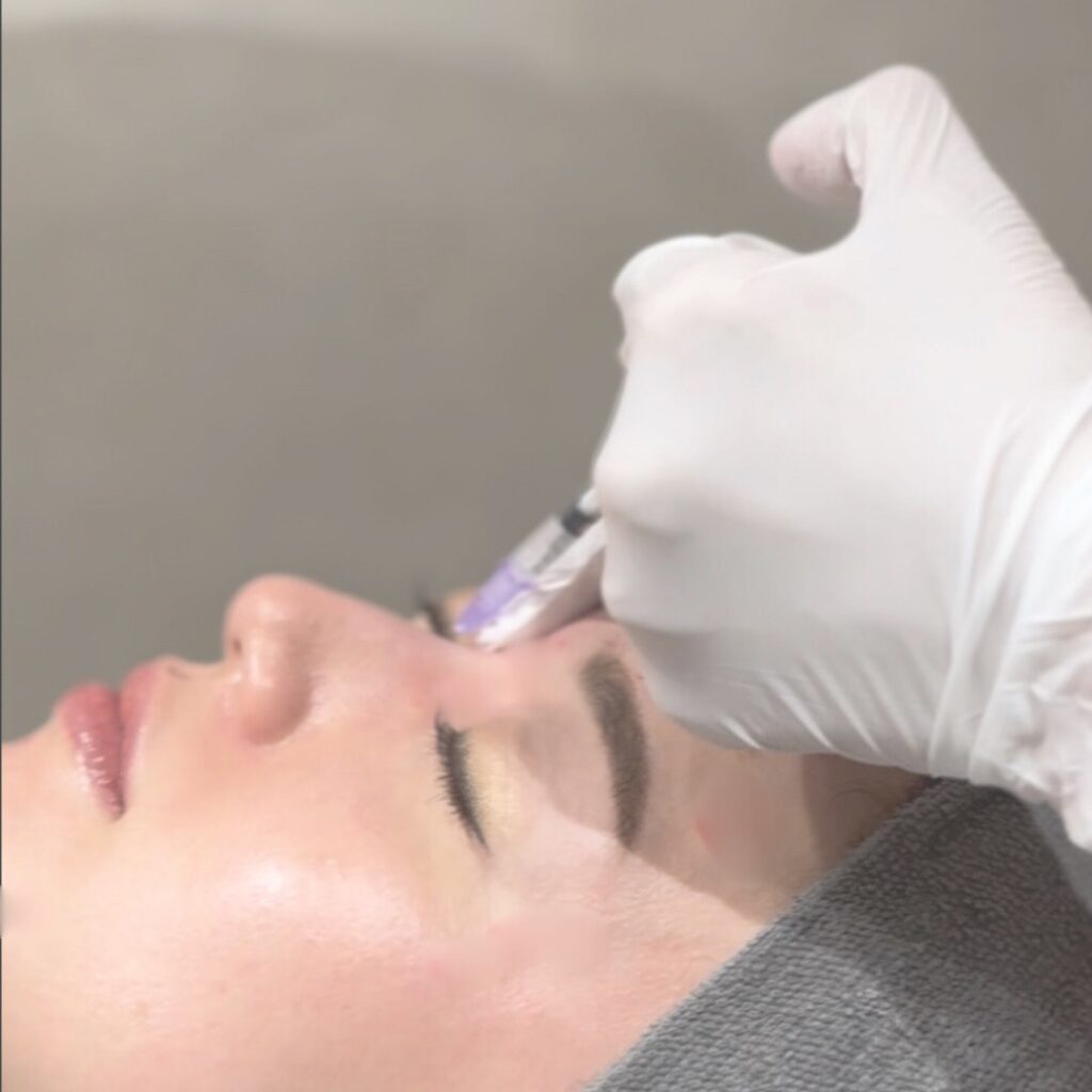 ボトックス注射のダウンタイムと術後の症状や注意点