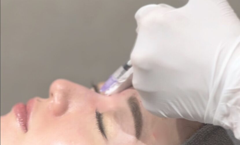 ボトックス注射のダウンタイムと術後の症状や注意点