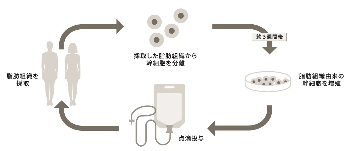 脂肪組織の採取から幹細胞の分離・培養、点滴投与までの流れ